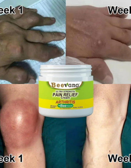 Bee Venom Pain Relief Cream